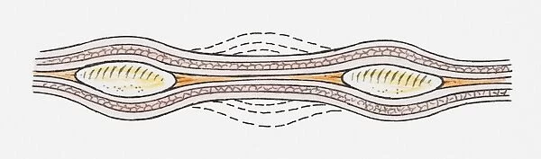 Illustration of contractions of muscles in the wall of the oesophagus (peristalsis)
