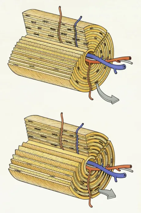 Framed Print : Illustration of cross section of normal bone structure with blood vessels in central canal