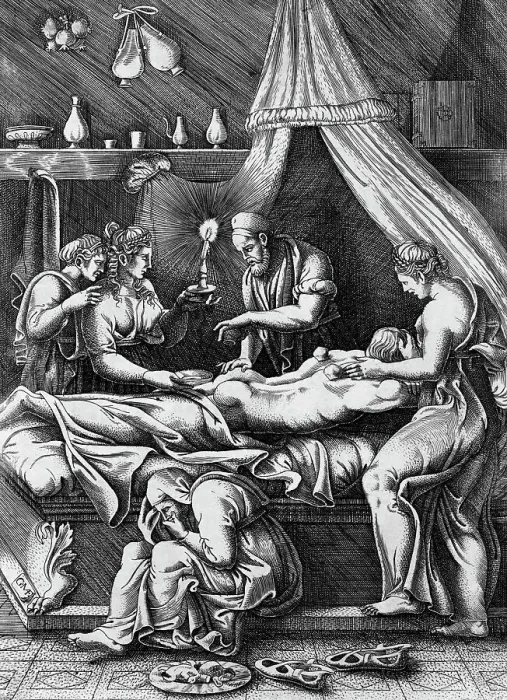 Framed Print : Illustration of Doctor Cupping Patient Framed Print : Illustration of Doctor Cupping Patient