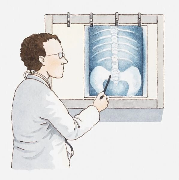 Illustration of doctor pointing at x-ray of pelvis and spine