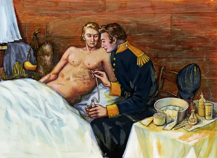 Framed Print : Illustration of Dr. William Beaumont Inserting Tube In Alexis St. Martin's Torso Framed Print : Illustration of Dr. William Beaumont Inserting Tube In Alexis St. Martin's Torso