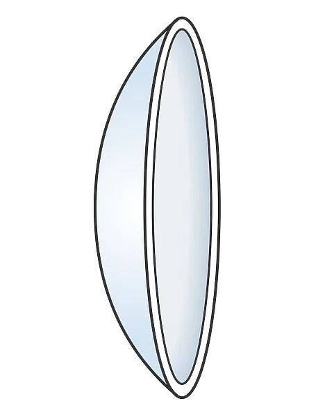 Illustration of hard contact lens