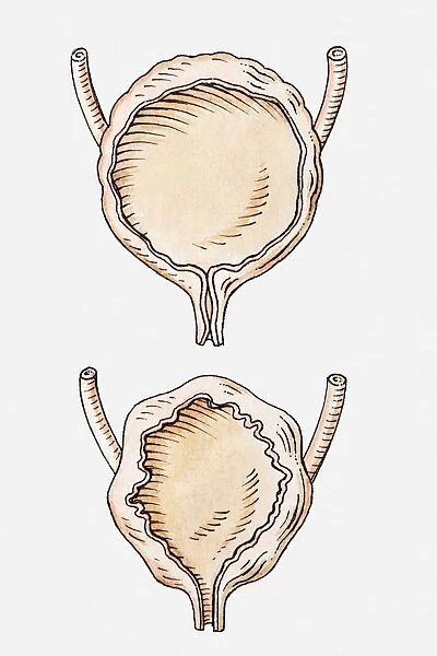 Illustration of full and empty human bladder