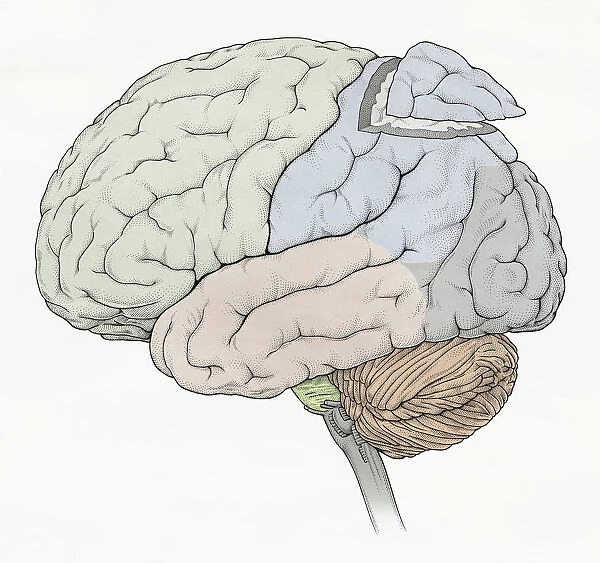 Illustration of human brain showing frontal, temporal, occipital lobes, section removed from parietal lobe, cerebellum and medulla oblongata