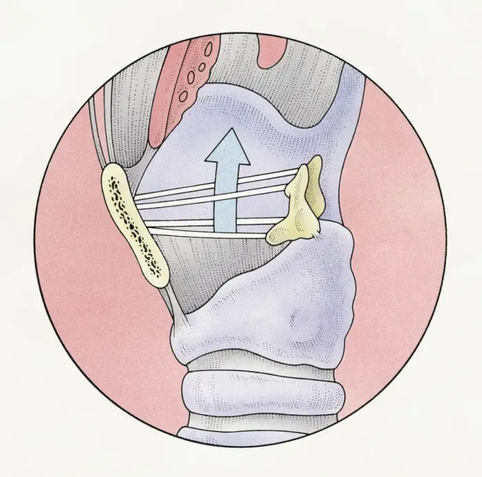 Framed Print : Illustration of human vocal cords and human larynx at top of trachea Framed Print : Illustration of human vocal cords and human larynx at top of trachea