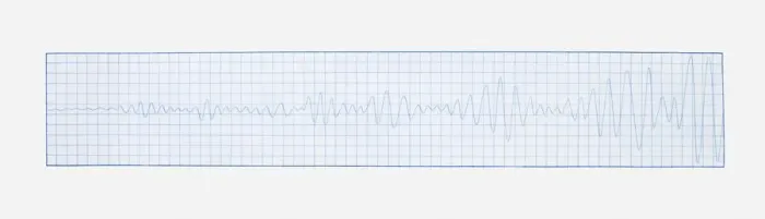 Framed Print : Illustration of lie detector read out Framed Print : Illustration of lie detector read out
