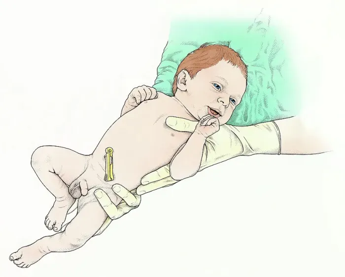 Framed Print : Illustration of midwife holding baby boy, with clamp on umbilical cord Framed Print : Illustration of midwife holding baby boy, with clamp on umbilical cord