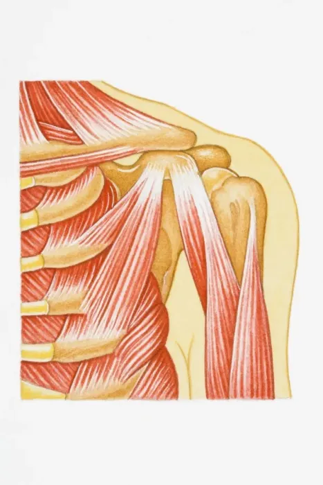 Framed Print : Illustration of separated shoulder, also known as a sprain, with circle around glenohumeral ligament Framed Print : Illustration of separated shoulder, also known as a sprain, with circle around glenohumeral ligament