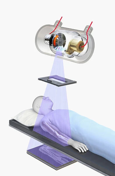 Illustration of X-ray machine being used on a patient