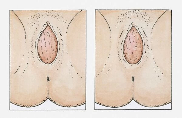 Two illustrations of babys head appearing from a pregnant womans vagina