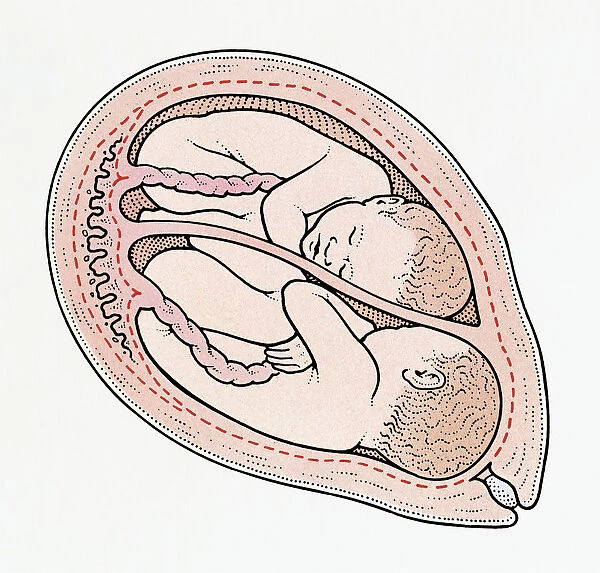 Illuystration of twin foetuses in normal position in cross section of human uterus