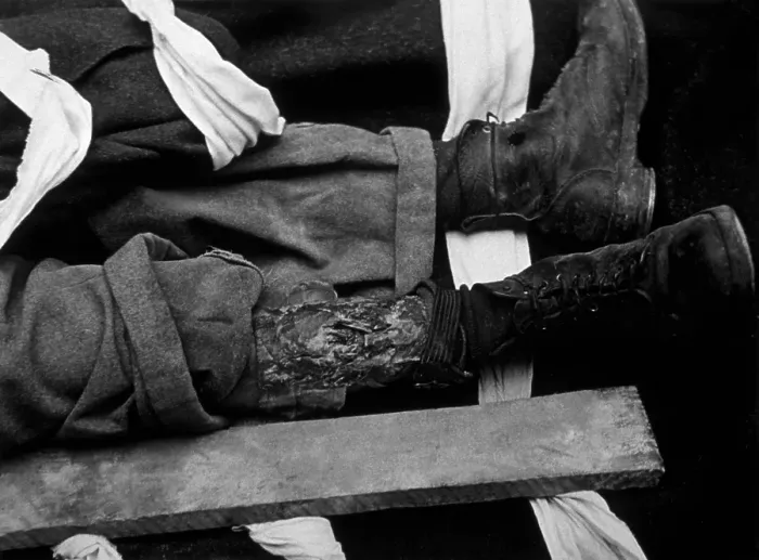 Framed Print : Injured Ankle Framed Print : Injured Ankle