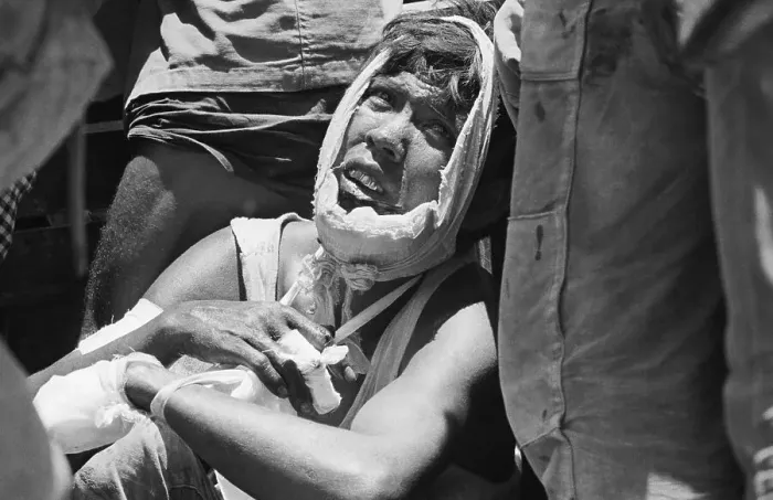 Framed Print : Injured Vietnamese Soldier Resting Framed Print : Injured Vietnamese Soldier Resting