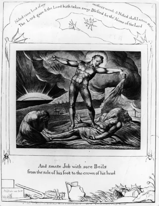 Framed Print : Job Smote With Boils Framed Print : Job Smote With Boils