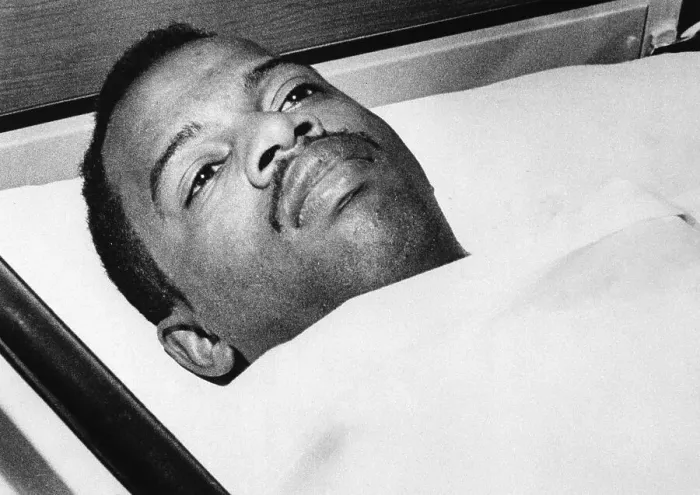 Framed Print : John Lewis In Hospital With Head Injury Framed Print : John Lewis In Hospital With Head Injury