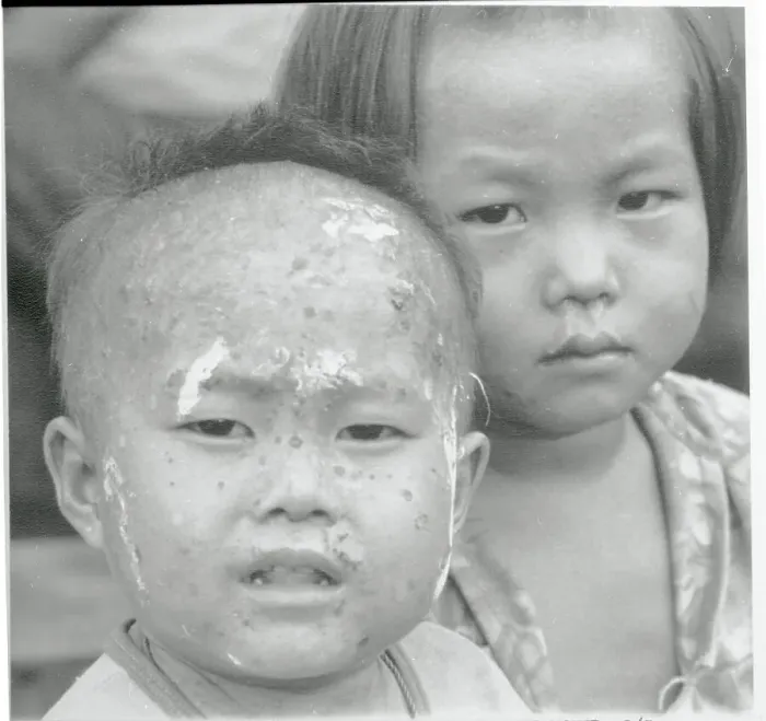 Framed Print : Laotian Refugee Children Framed Print : Laotian Refugee Children