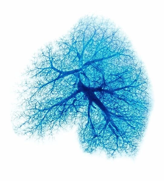 Lung, X-ray