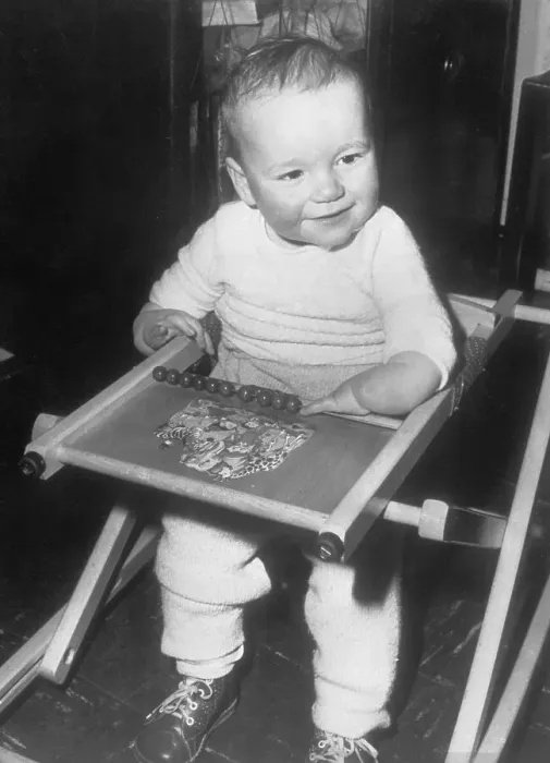 Framed Print : Malformed Baby of Thalidomide