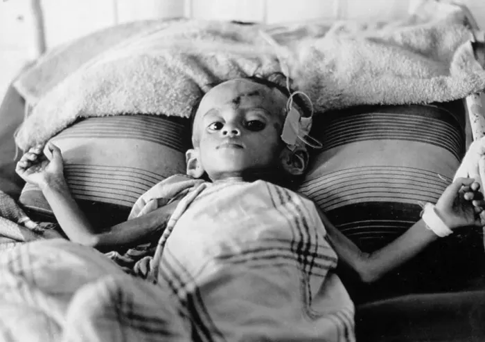 Framed Print : Malnourished Cambodian Child Framed Print : Malnourished Cambodian Child
