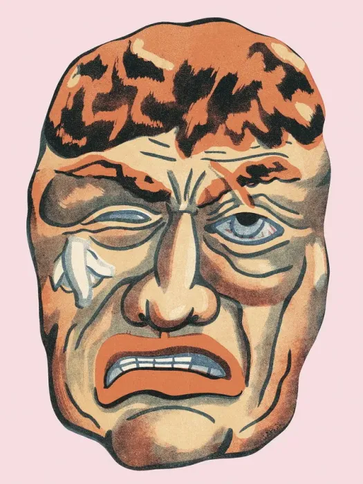Framed Print : Man with exposed brain Framed Print : Man with exposed brain