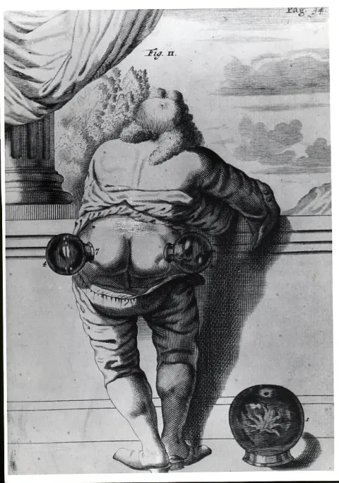 Framed Print : Man With Glass Tubes On Posterior;Engrav