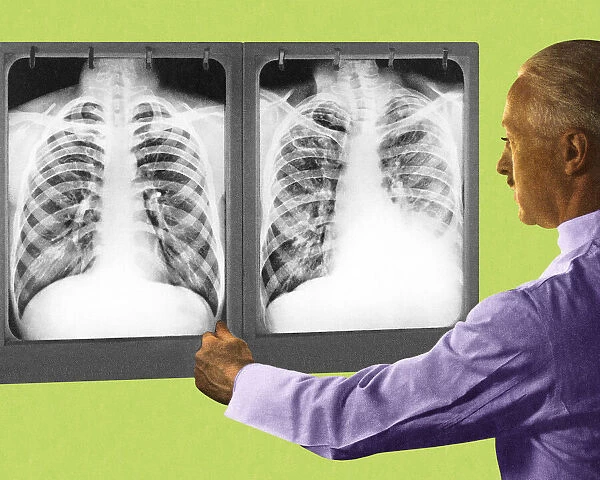 Man Looking at Two Chest X-Rays