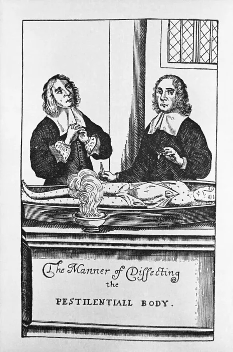 Framed Print : The Manner of Dissecting the Pestilentiall Body Illustration Framed Print : The Manner of Dissecting the Pestilentiall Body Illustration
