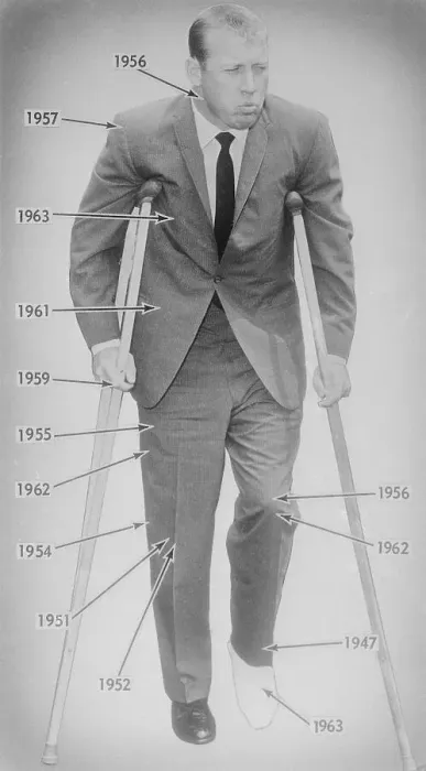 Framed Print : Mickey Mantle Standing with Crutches Framed Print : Mickey Mantle Standing with Crutches