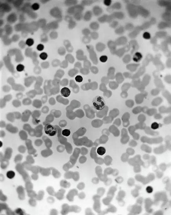 Framed Print : Microscopic View Of Human Blood Framed Print : Microscopic View Of Human Blood
