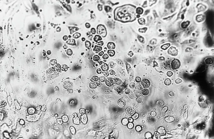Framed Print : Microscopic View Of Virus-Infected Cell Framed Print : Microscopic View Of Virus-Infected Cell