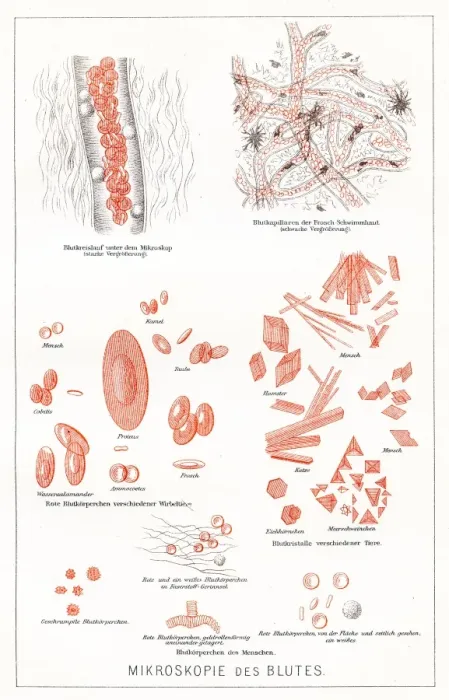 Framed Print : Microscopy of the blood anatomy engraving 1857 Framed Print : Microscopy of the blood anatomy engraving 1857