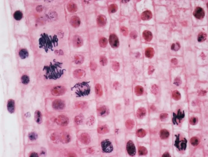 Framed Print : Mitosis, LM Framed Print : Mitosis, LM