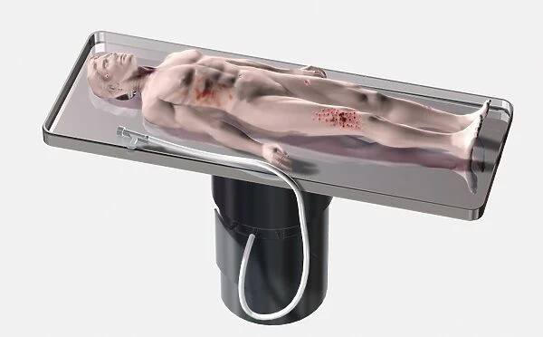 Model of a dead body lying on a morgue table with various injuries