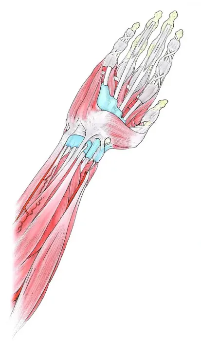 Framed Print : Muscles in human hand and arm Framed Print : Muscles in human hand and arm