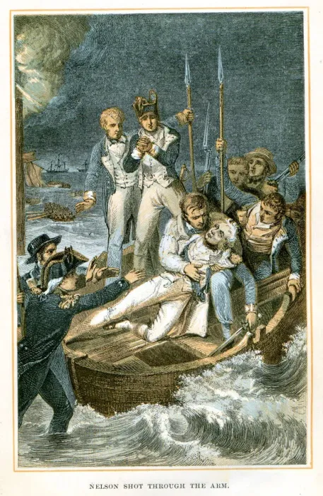 Framed Print : Nelson shot through the arm