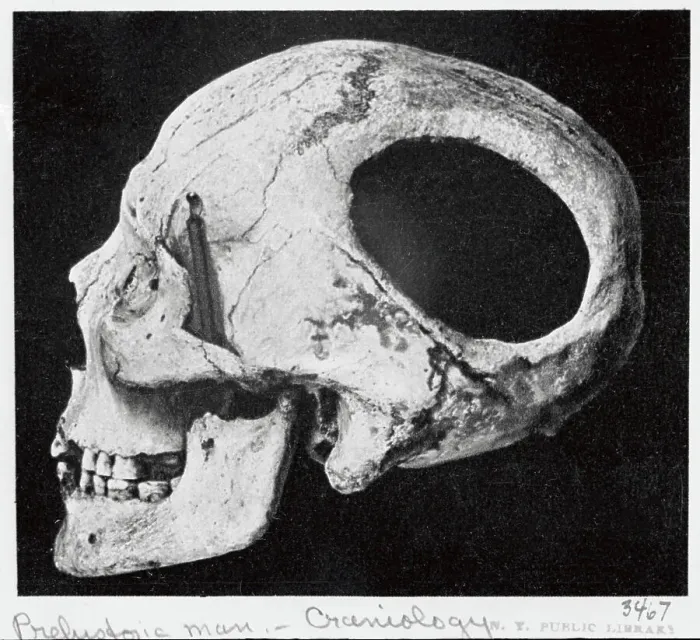 Framed Print : Neolithic Skull Found at Nogent-les-Vierges Framed Print : Neolithic Skull Found at Nogent-les-Vierges