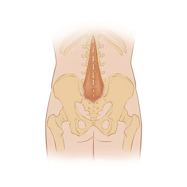Normal posterior view of the back highlighting the multifidus muscle