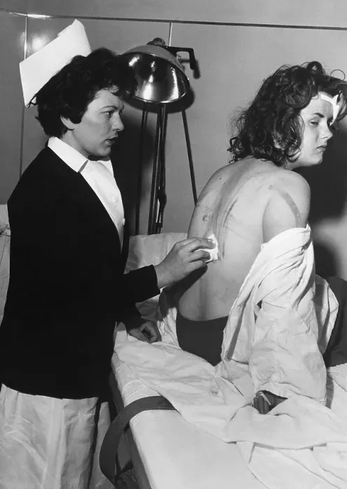 Framed Print : Nurse Treating Welts on Woman's Back Framed Print : Nurse Treating Welts on Woman's Back