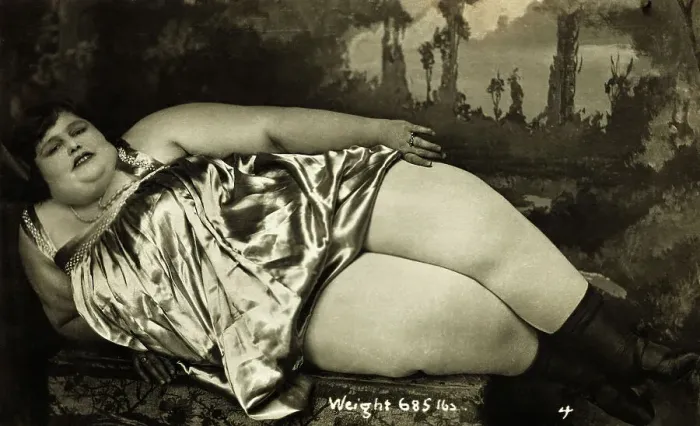 Framed Print : Obese Woman Lying On Chair Framed Print : Obese Woman Lying On Chair