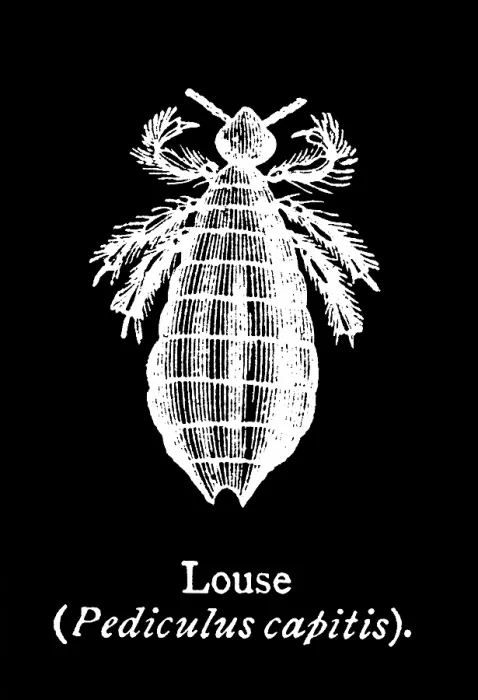 Framed Print : Old engraved illustration of insect, Head louse (Pediculus humanus capitis) Framed Print : Old engraved illustration of insect, Head louse (Pediculus humanus capitis)