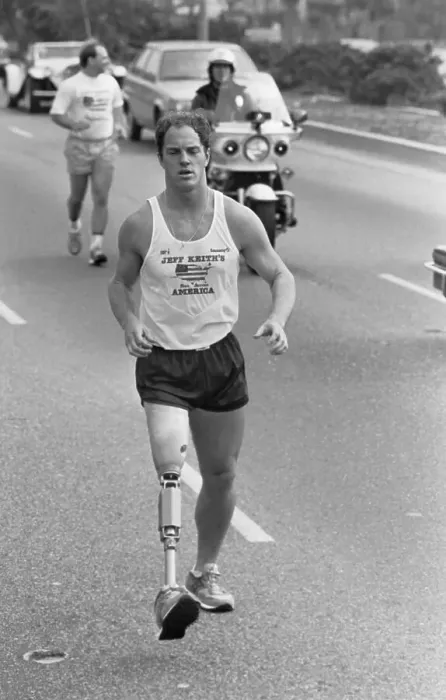 Framed Print : One-Legged Cancer Victim Jogging Framed Print : One-Legged Cancer Victim Jogging