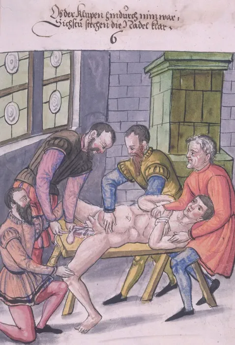 Framed Print : Operating Table Framed Print : Operating Table