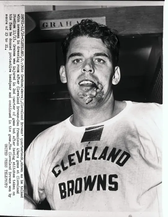 Framed Print : Otto Graham With Bloody and Injured Jaw Framed Print : Otto Graham With Bloody and Injured Jaw
