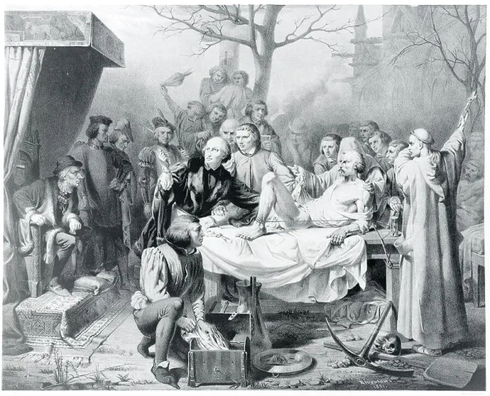 Framed Print : Painting of an Early Operation Framed Print : Painting of an Early Operation