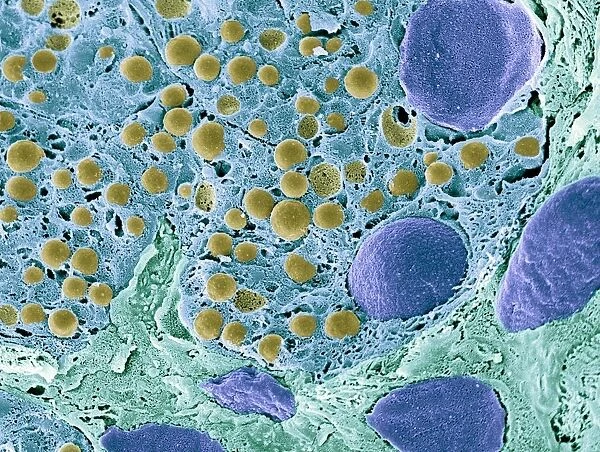Pancreas tissue, colored scanning electron micrograph
