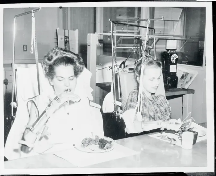 Framed Print : Two Patients Eating Their Food with the Help of Specialized Equipment Framed Print : Two Patients Eating Their Food with the Help of Specialized Equipment