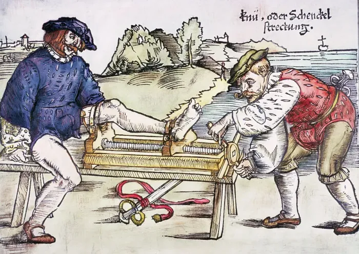 Framed Print : Physician Setting Broken Knee Framed Print : Physician Setting Broken Knee