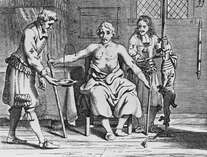 Framed Print : Physicians and Patient During Early Blood Transfusion Framed Print : Physicians and Patient During Early Blood Transfusion