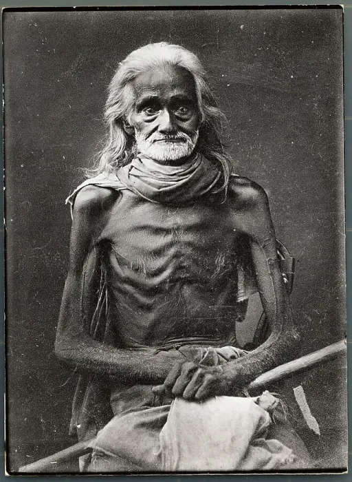 Framed Print : Portrait of Emaciated Man Framed Print : Portrait of Emaciated Man