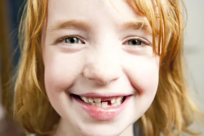 Framed Print : Portrait of a girl with red hair with a missing tooth Framed Print : Portrait of a girl with red hair with a missing tooth